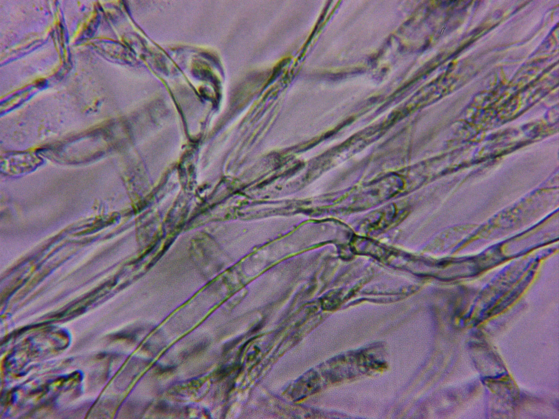 Microscopía de Stropharia caerulea - 12 - Hifas cutícula fibuladas